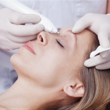 1-6 darab szemölcs eltávolítása bőrgyógyász-kozmetológus szakorvos által