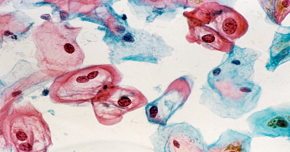 FÓKUSZBAN A VÍRUSOK - Méhnyakrák megelőzési hét a pandémiában