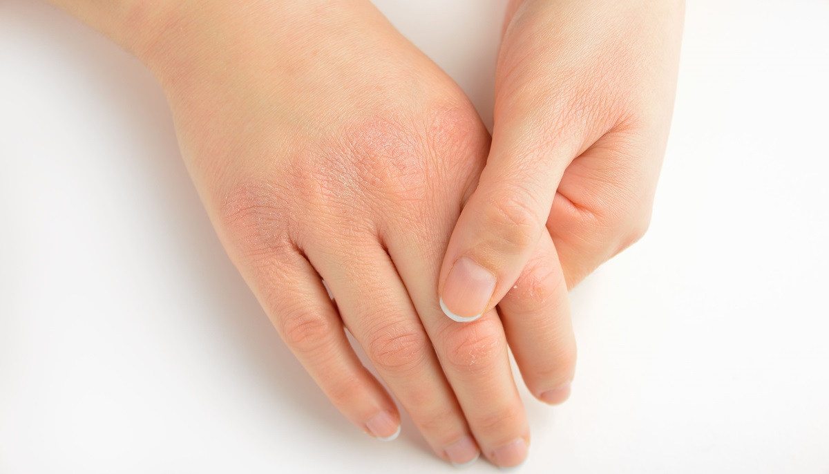 5 szokatlan tünet, ami vitaminhiányt jelez, és a megoldás