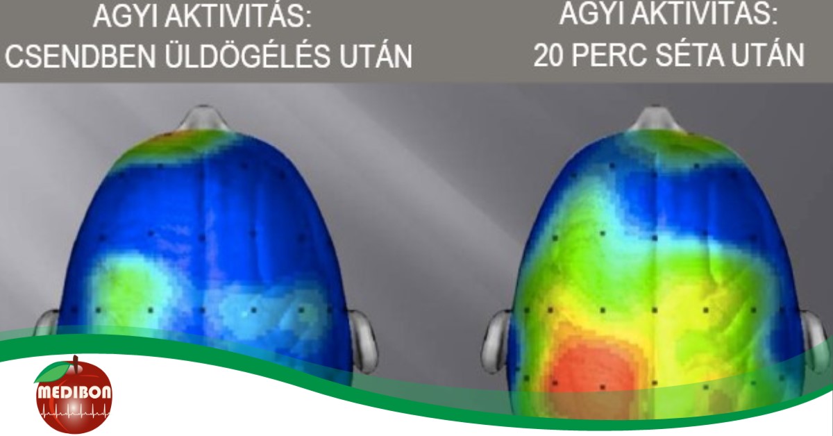 7 meghökkentő agykárosító szokás
