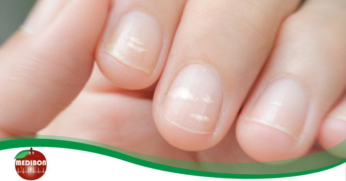 7 fehérjehiányra utaló tünet