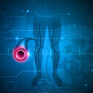 Alsó végtagi artériás, vénás keringési Doppler vizsgálat a trombózis, üszkösödés, lábszárfekély ellen.
