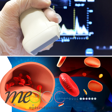 Angiológiai szakorvosi vizsgálat csomag