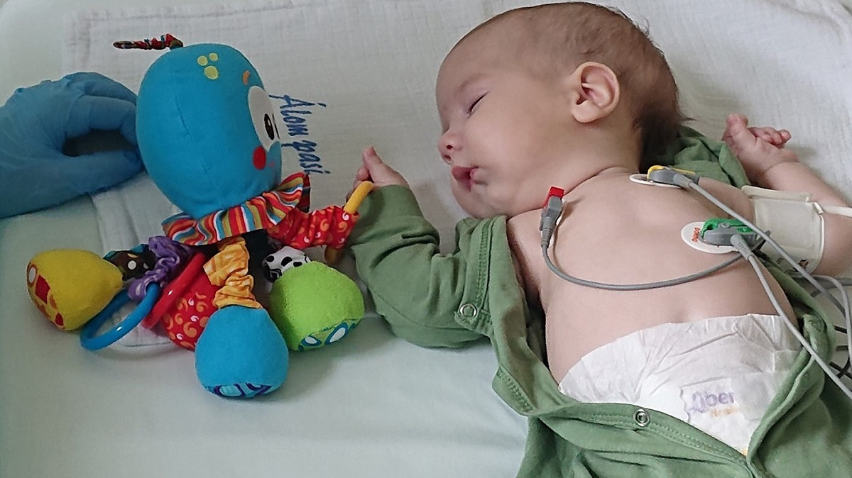 Az eddigi legfiatalabb SMA-s csecsemő génterápiás kezelése hazánkban