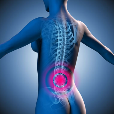 Dr. Yamamoto féle mágneses derékfűző a derék bajai ellen 