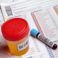 Végre elfelejtheted a kínos pillanatokat. Emésztési zavarok kimutatása laborvizsgálattal: Gasztroenterális panel + Helicobacter Pylori vizsgálat + … 