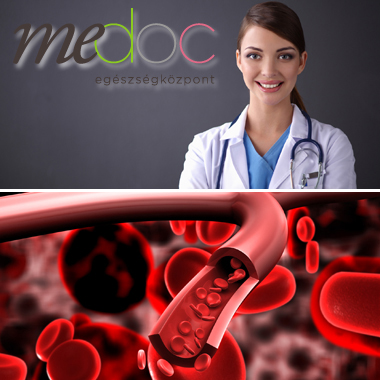 Kardiológiai szakorvosi vizsgálat, arteriográfos érvizsgálattal