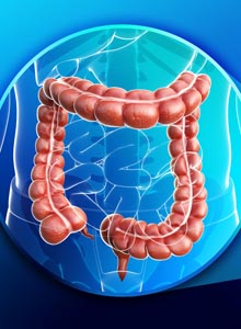 Ne a véged legyen a véged - avagy a vastagbélrákról
