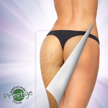 Azoknak, akik nem egyeznek ki a narancsbőrrel és a plusz kilókkal: Prémium cellulitkezelő, alakformáló csomag