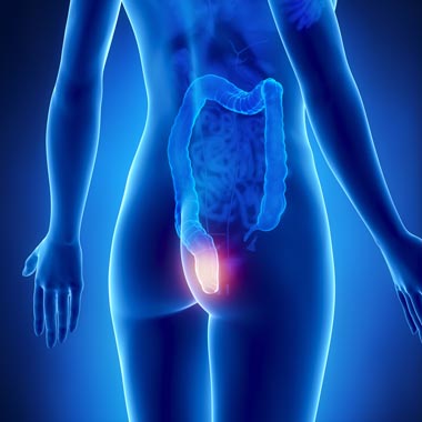 Proktológiai vizsgálat végbélrák megelőző állapotok és aranyér problémák szűrésére