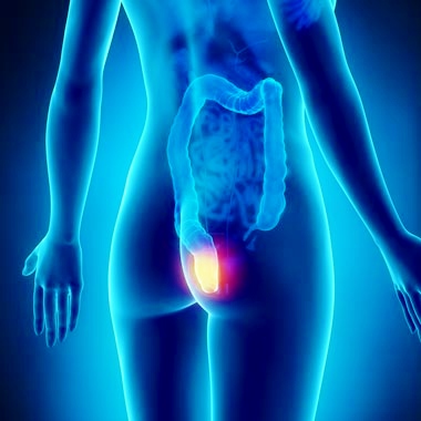 Proktológiai vizsgálat aranyérpanaszok orvoslására és végbélrák megelőzésre