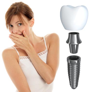 Hiánypótló bón: Teljes értékű fogpótlás, rejtett költségek nélkül