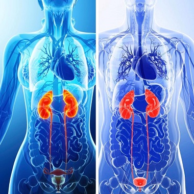 Urológiai vizsgálatcsomag ultrahanggal Nőknek, Férfiaknak