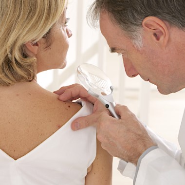 Szakorvosi dermatoszkópos anyajegyszűrés a teljes testen, konzultációval