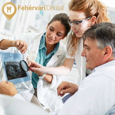 Digitális panoráma röntgen, konzultációval és hazavihető kezelési tervvel előleg