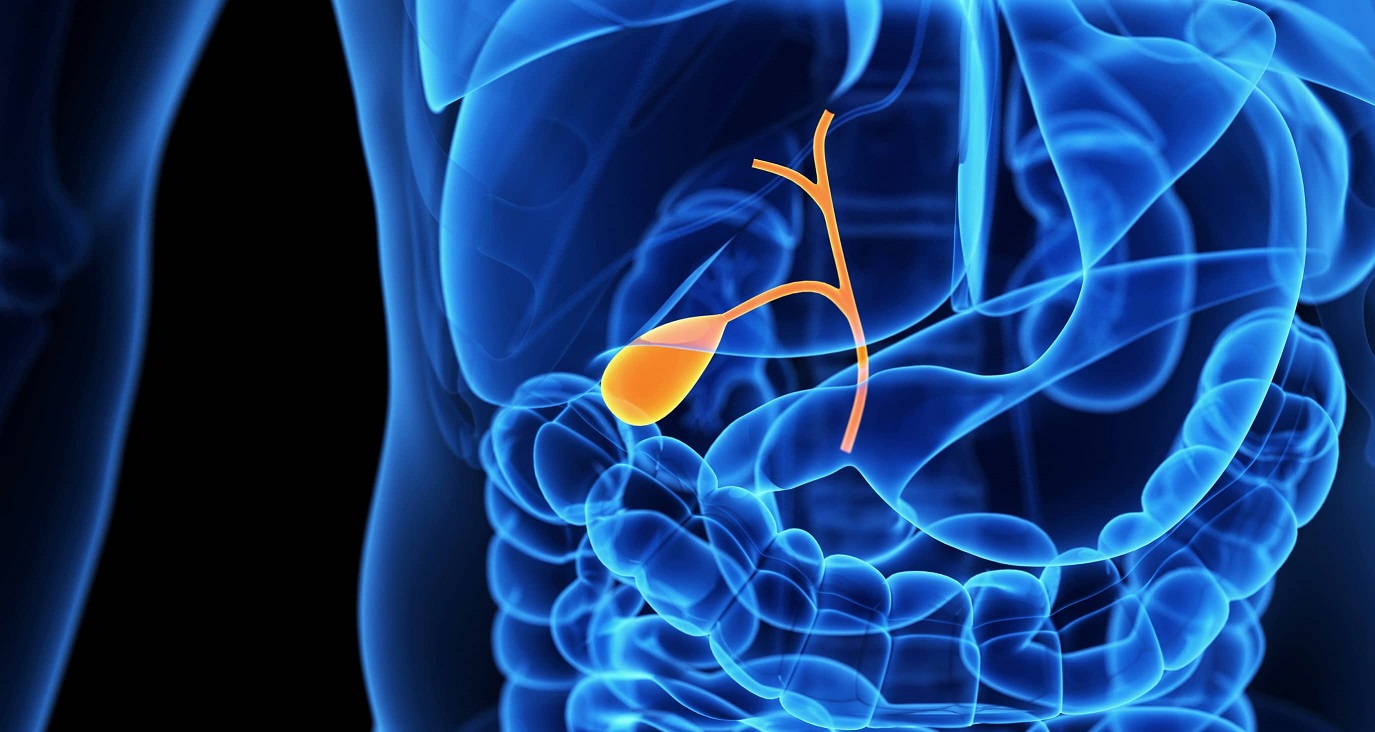 Szabad vagy tilos? Ételek epebetegeknek