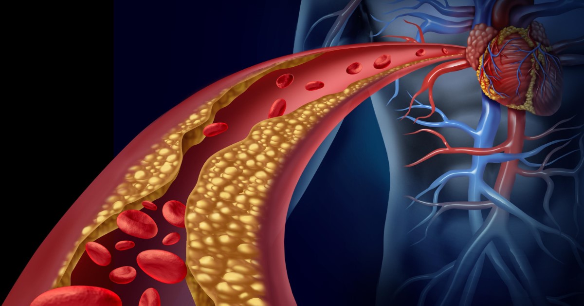 ÉRBETEGSÉGEK NAPJA: 2019 március 21 - Ingyenes szűrésekkel