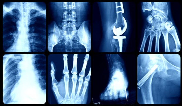 Érdekességek a csontjainkról