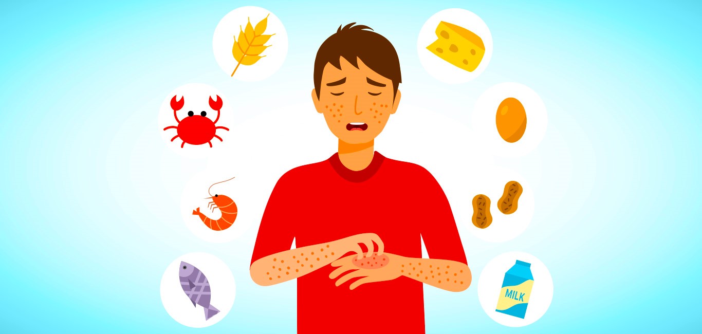 4 ételallergia tünetcsoport: enyhéktől a súlyosig