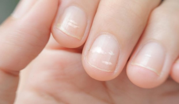 7 fehérjehiányra utaló tünet