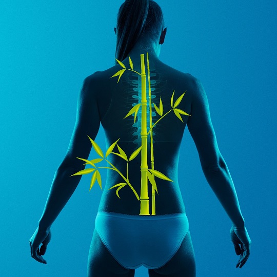 3 alkalmas Gerinc Selfness program, Magyarországon CSAK a Gerinc Műhelyben