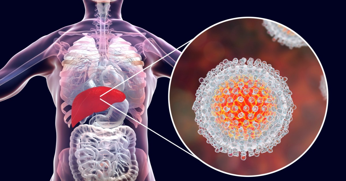 INGYENES HEPATITIS C SZŰRÉS ORSZÁGSZERTE- 2019 SZEPTEMBER 28