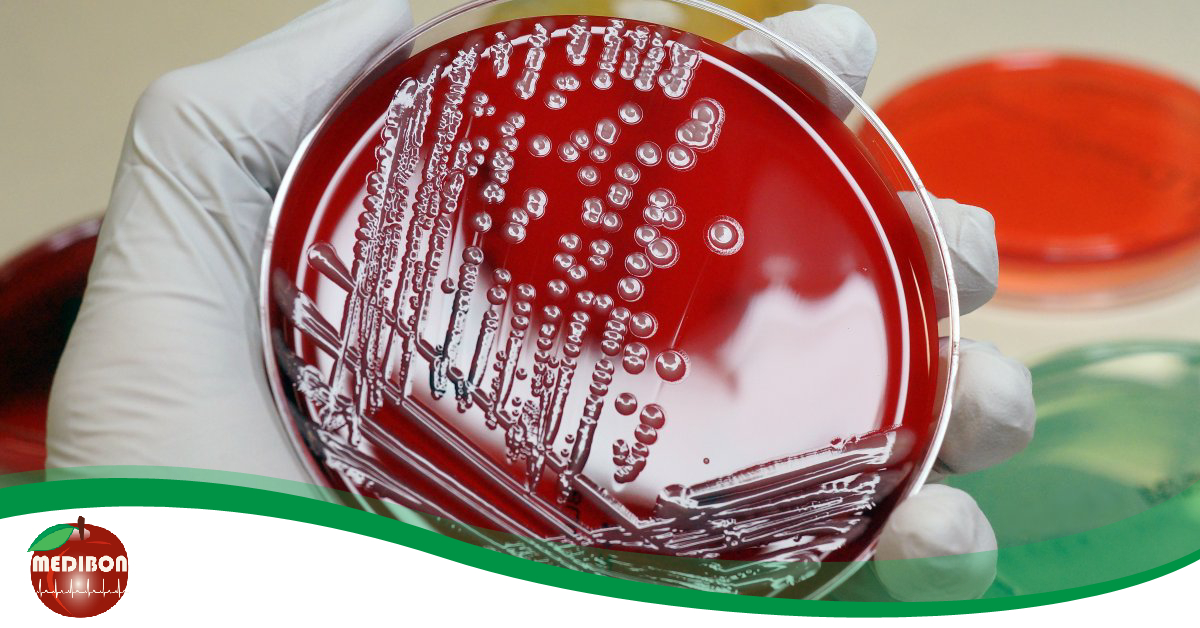 A húgyúti fertőzésekről és megelőzésükről