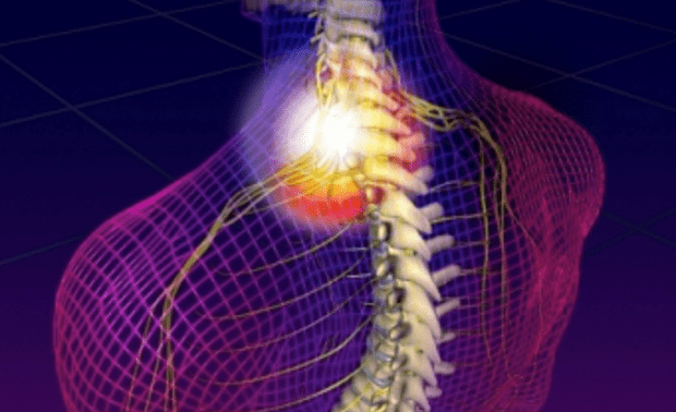 Segítség: Becsípődött