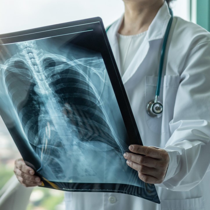 Kedvezményes kisrutin laboratóriumi vizsgálat mellkasi röntgennel a Budai Magánorvosi Centrumban.