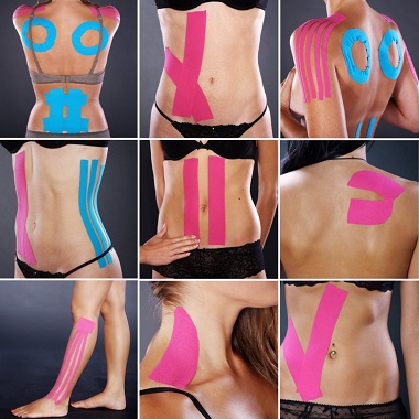 Kineziológiai tapasz felhelyezése mozgásszervi fájdalmakra, az Újbuda Medical Centerben