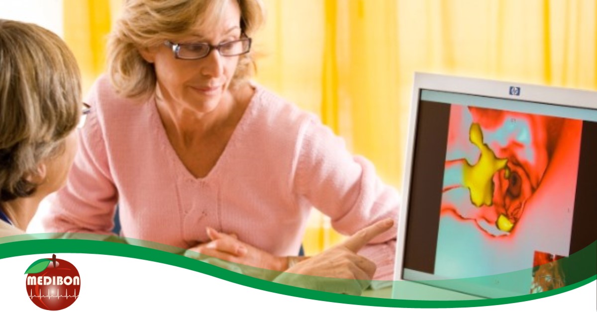 Koleszterin: tévhitek, féligazságok, és tények