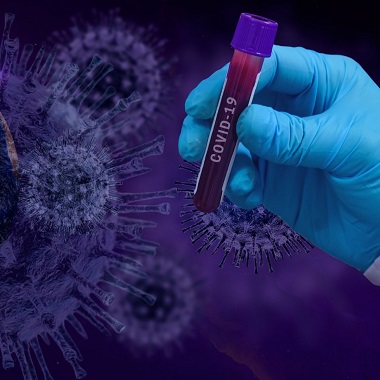 Koronavírus (COVID-19) szerológiai teszt a MyDoctor Egészségközpontban