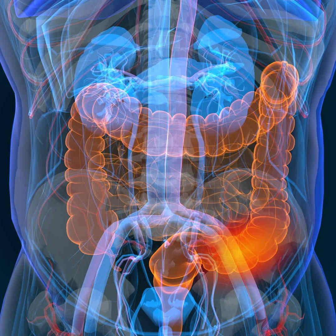 Laboratóriumi bélrendszeri daganatszűrés, rutin vizsgálatok, pajzsmirigy szűrés előleg