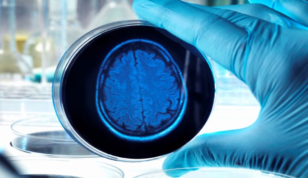 Bizonyított: magas vérnyomás csökkentés - demencia kockázat csökkenés!