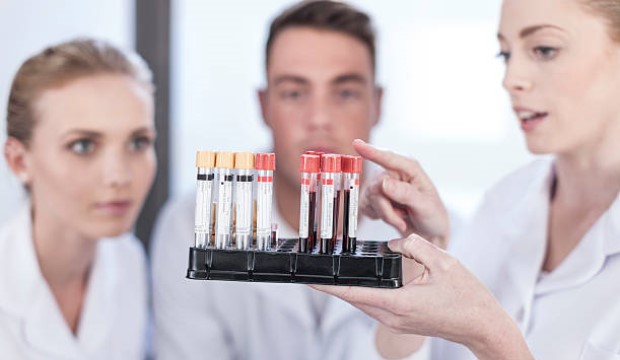 Egy egyszerű vérteszttel kimutatható lesz a melanoma