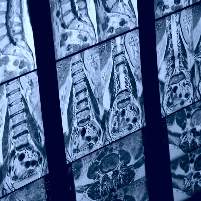 Nyitott készülékkel történő natív MRI vizsgálat választható régióra, hazavihető lelettel, radiológus szakorvosi kiértékeléssel