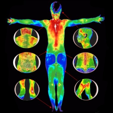 Orvosi termográfiás állapotfelmérés, konzultációval