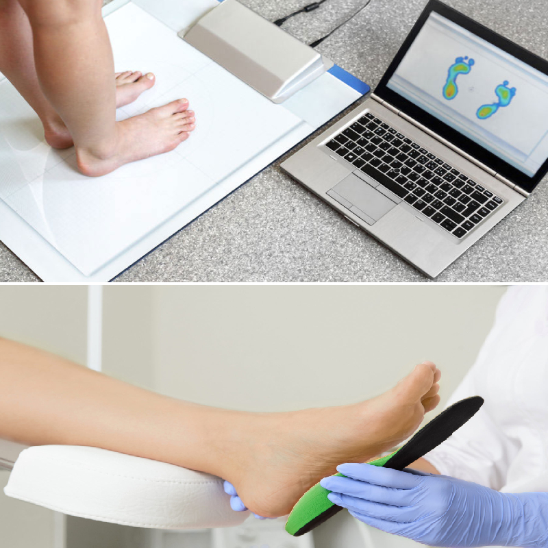 Podoszkópos lábvizsgálat + speciális, egyedi talpbetét. 