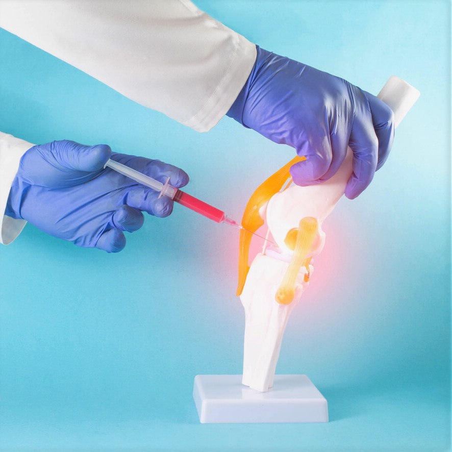 Forradalmi ízületi PRP terápia az Arthro Komplex Gyógyközpontban előleg