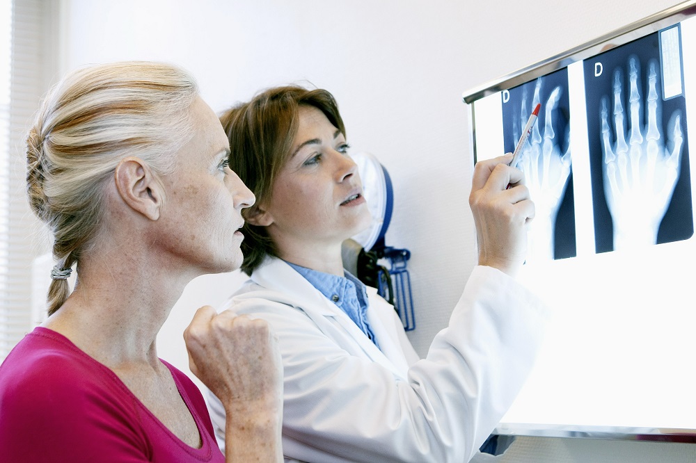 A 40 feletti nők réme: A reumás ízületi gyulladás