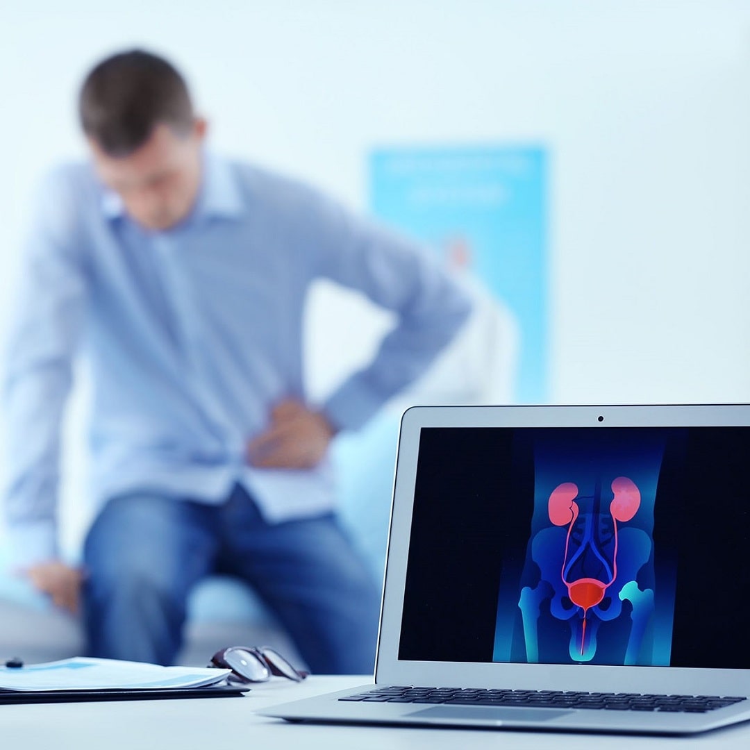 Szakorvosi urológiai szűrés ultrahanggal, és laboratóriumi PSA vizsgálat, előleggel